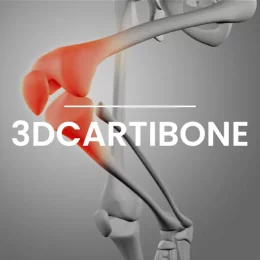 3DCARTIBONE